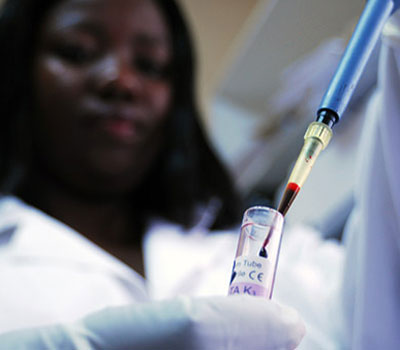 Research on HIV and AIDS